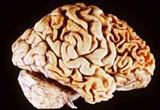 Courtesy Wikipedia brain