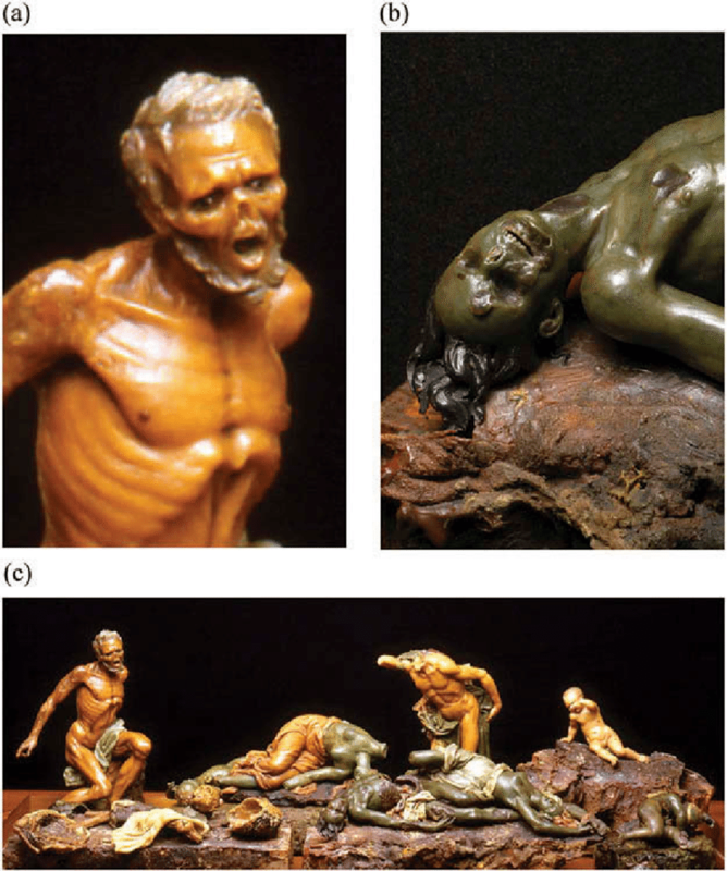 photo Gaetano-Zumbo-La-Sifilide-Syphilis-Museum-of-Natural-History-La-Specola-Florence.png