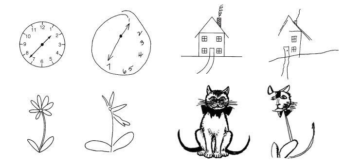 photo hemispatial-neglect-drawings_1.jpg